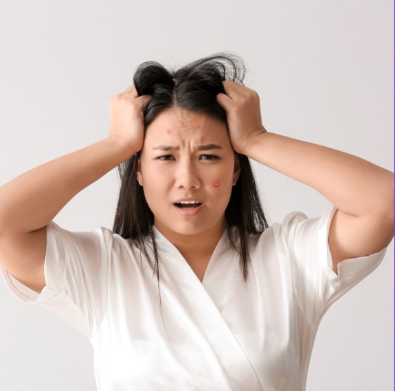 Retinoide Isotretinoína